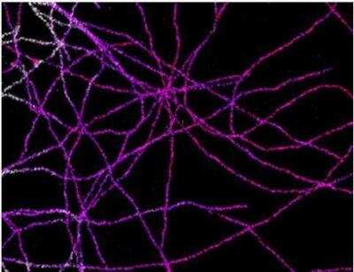 Immunofluorescence: VECTASHIELD(R) Antifade Mounting Medium [H-1000-NB]