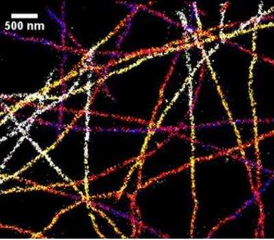 Immunofluorescence: VECTASHIELD(R) Antifade Mounting Medium [H-1000-NB]