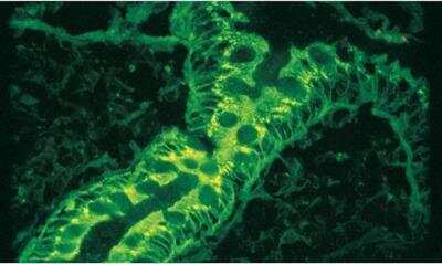 Immunohistochemistry: VECTASHIELD(R) Antifade Mounting Medium [H-1000-NB]