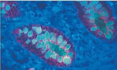 Immunohistochemistry: VECTASHIELD(R) Antifade Mounting Medium [H-1000-NB]