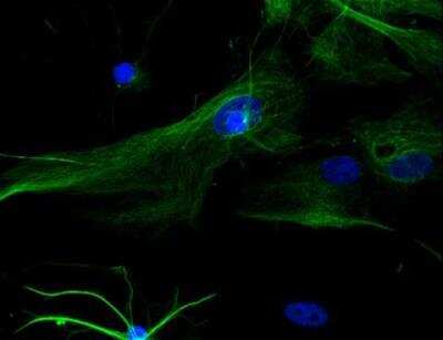 Immunocytochemistry/ Immunofluorescence: VECTASHIELD(R) HardSet(TM) Antifade Mounting Medium with DAPI [H-1500-NB]