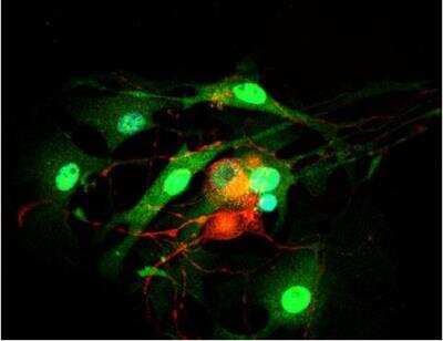 Immunocytochemistry/ Immunofluorescence: VECTASHIELD(R) HardSet(TM) Antifade Mounting Medium with DAPI [H-1500-NB]