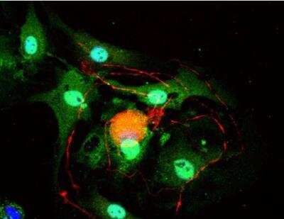 Immunocytochemistry/ Immunofluorescence: VECTASHIELD(R) HardSet(TM) Antifade Mounting Medium with DAPI [H-1500-NB]