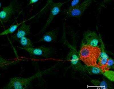 Immunocytochemistry/ Immunofluorescence: VECTASHIELD(R) HardSet(TM) Antifade Mounting Medium with DAPI [H-1500-NB]
