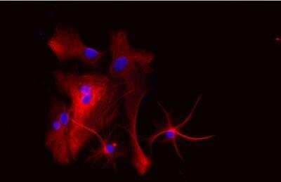 Immunocytochemistry/ Immunofluorescence: VECTASHIELD(R) HardSet(TM) Antifade Mounting Medium with DAPI [H-1500-NB]