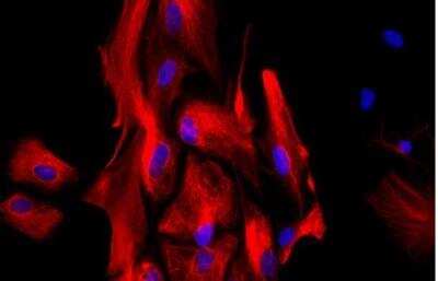 Immunocytochemistry/ Immunofluorescence: VECTASHIELD(R) HardSet(TM) Antifade Mounting Medium with DAPI [H-1500-NB]