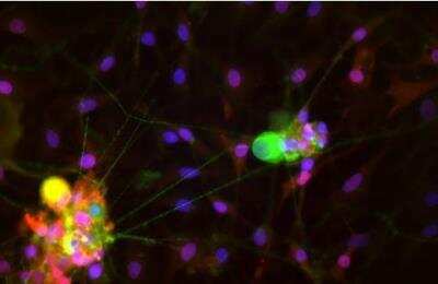 Immunocytochemistry/ Immunofluorescence: VECTASHIELD(R) HardSet(TM) Antifade Mounting Medium with DAPI [H-1500-NB]