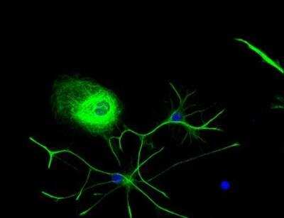 Immunocytochemistry/ Immunofluorescence: VECTASHIELD(R) HardSet(TM) Antifade Mounting Medium with DAPI [H-1500-NB]