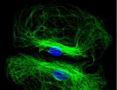 Immunocytochemistry/ Immunofluorescence: VECTASHIELD(R) HardSet(TM) Antifade Mounting Medium with DAPI [H-1500-NB]