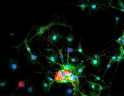 Immunocytochemistry/ Immunofluorescence: VECTASHIELD(R) HardSet(TM) Antifade Mounting Medium with DAPI [H-1500-NB]
