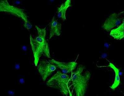 Immunocytochemistry/ Immunofluorescence: VECTASHIELD(R) HardSet(TM) Antifade Mounting Medium with DAPI [H-1500-NB]