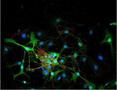 Immunocytochemistry/ Immunofluorescence: VECTASHIELD(R) HardSet(TM) Antifade Mounting Medium with DAPI [H-1500-NB]