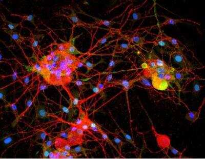 Immunocytochemistry/ Immunofluorescence: VECTASHIELD(R) HardSet(TM) Antifade Mounting Medium with DAPI [H-1500-NB]