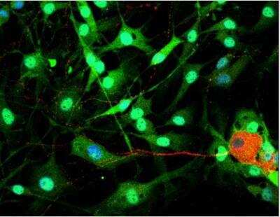 Immunocytochemistry/ Immunofluorescence: VECTASHIELD(R) HardSet(TM) Antifade Mounting Medium with DAPI [H-1500-NB]