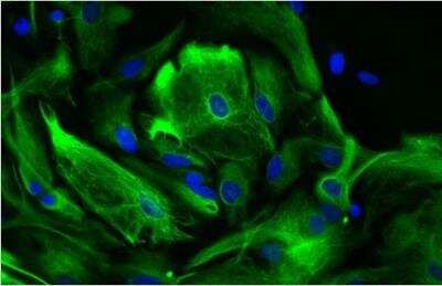Immunocytochemistry/ Immunofluorescence: VECTASHIELD(R) HardSet(TM) Antifade Mounting Medium with DAPI [H-1500-NB]