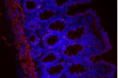 Immunohistochemistry: VECTASHIELD(R) HardSet(TM) Antifade Mounting Medium with DAPI [H-1500-NB]