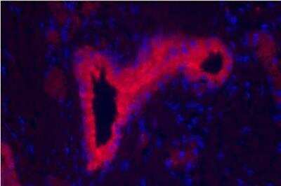 Immunohistochemistry: VECTASHIELD(R) HardSet(TM) Antifade Mounting Medium with DAPI [H-1500-NB]