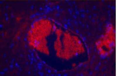 Immunohistochemistry: VECTASHIELD(R) HardSet(TM) Antifade Mounting Medium with DAPI [H-1500-NB]