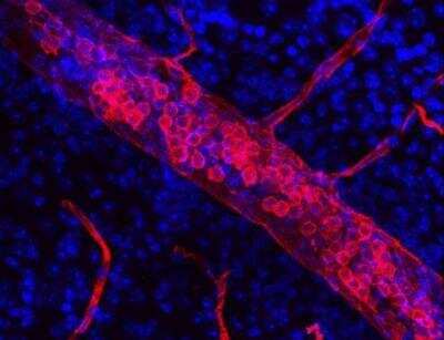 Immunohistochemistry: VECTASHIELD(R) HardSet(TM) Antifade Mounting Medium with DAPI [H-1500-NB]