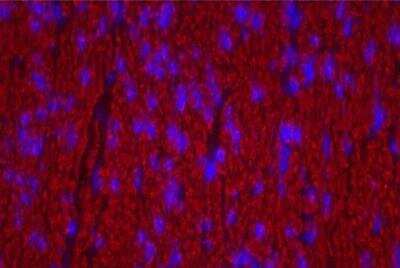 Immunohistochemistry: VECTASHIELD(R) HardSet(TM) Antifade Mounting Medium with DAPI [H-1500-NB]