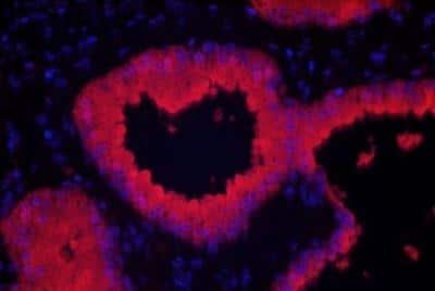 Immunohistochemistry: VECTASHIELD(R) HardSet(TM) Antifade Mounting Medium with DAPI [H-1500-NB]