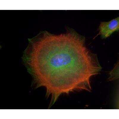 Immunocytochemistry/ Immunofluorescence: VECTASHIELD(R) HardSet(TM) Antifade Mounting Medium with Phalloidin [H-1600-NB]