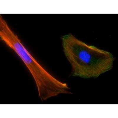 Immunocytochemistry/ Immunofluorescence: VECTASHIELD(R) HardSet(TM) Antifade Mounting Medium with Phalloidin [H-1600-NB]