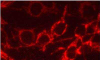 Immunocytochemistry/ Immunofluorescence: VECTASHIELD(R) HardSet(TM) Antifade Mounting Medium [H-1400-NB]