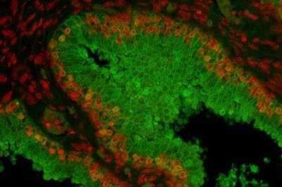 Immunohistochemistry: VECTASHIELD(R) HardSet(TM) Antifade Mounting Medium [H-1400-NB]