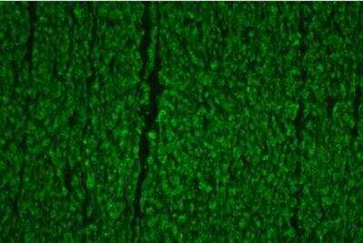 Immunohistochemistry: VECTASHIELD(R) HardSet(TM) Antifade Mounting Medium [H-1400-NB]