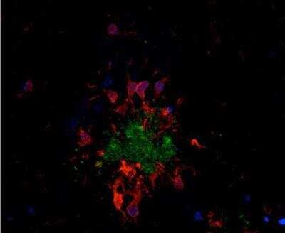 Immunohistochemistry: VECTASHIELD(R) HardSet(TM) Antifade Mounting Medium [H-1400-NB]