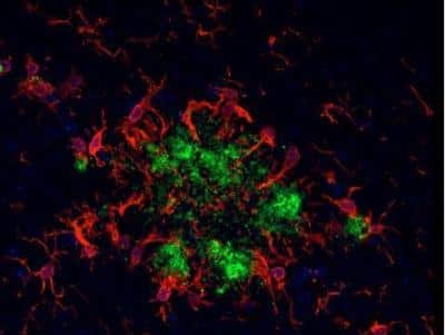 Immunohistochemistry: VECTASHIELD(R) HardSet(TM) Antifade Mounting Medium [H-1400-NB]