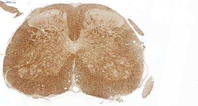 Immunohistochemistry: VECTASTAIN(R) ABC anti-Mouse IgG HRP Immunodetection Kit [PK-4002-NB]