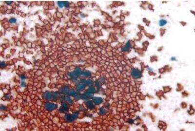 Immunohistochemistry: VECTASTAIN(R) ABC anti-mouse/rabbit AP Immunodetection Kit [AK-5200-NB]