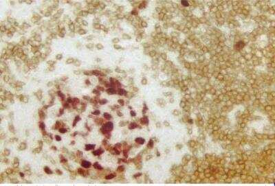 Immunohistochemistry: VECTASTAIN(R) ABC anti-mouse/rabbit AP Immunodetection Kit [AK-5200-NB]