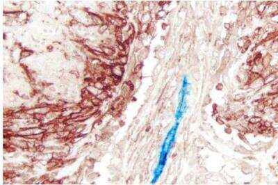 Immunohistochemistry: VECTASTAIN(R) ABC anti-mouse/rabbit AP Immunodetection Kit [AK-5200-NB]