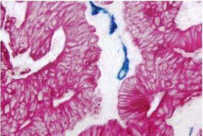 Immunohistochemistry: VECTASTAIN(R) ABC anti-mouse/rabbit AP Immunodetection Kit [AK-5200-NB]