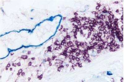 Immunohistochemistry: VECTASTAIN(R) ABC anti-mouse/rabbit AP Immunodetection Kit [AK-5200-NB]