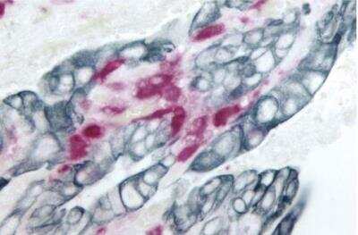 Immunohistochemistry: VECTASTAIN(R) ABC anti-mouse/rabbit AP Immunodetection Kit [AK-5200-NB]