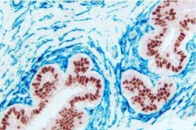 Immunohistochemistry: VECTASTAIN(R) ABC anti-mouse/rabbit AP Immunodetection Kit [AK-5200-NB]