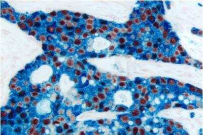 Immunohistochemistry: VECTASTAIN(R) ABC anti-mouse/rabbit AP Immunodetection Kit [AK-5200-NB]