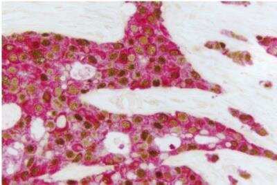 Immunohistochemistry: VECTASTAIN(R) ABC anti-mouse/rabbit AP Immunodetection Kit [AK-5200-NB]