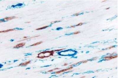 Immunohistochemistry: VECTASTAIN(R) ABC anti-mouse/rabbit AP Immunodetection Kit [AK-5200-NB]