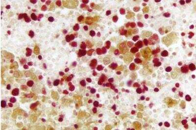 Immunohistochemistry: VECTASTAIN(R) ABC anti-mouse/rabbit AP Immunodetection Kit [AK-5200-NB]
