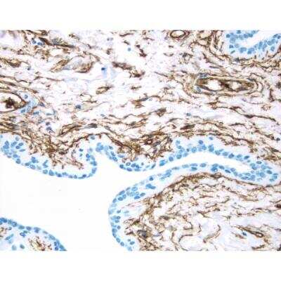 Immunohistochemistry: VECTASTAIN(R) ELITE(R) ABC anti-Mouse IgG HRP Immunodetection Kit [PK-6102-NB]
