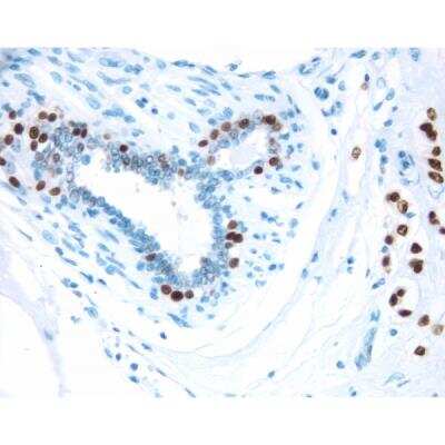 Immunohistochemistry: VECTASTAIN(R) ELITE(R) ABC anti-Mouse IgG HRP Immunodetection Kit [PK-6102-NB]