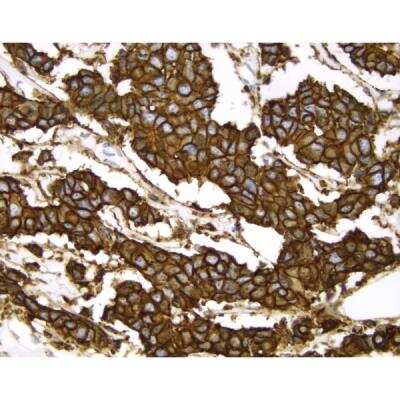 Immunohistochemistry: VECTASTAIN(R) ELITE(R) ABC anti-Mouse IgG HRP Immunodetection Kit [PK-6102-NB]