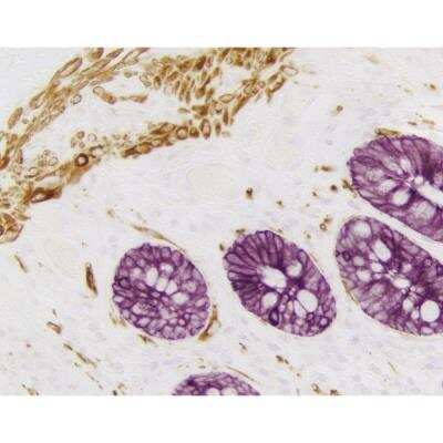 Immunohistochemistry: VECTASTAIN(R) ELITE(R) ABC anti-Mouse IgG HRP Immunodetection Kit [PK-6102-NB]