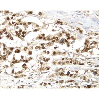 Immunohistochemistry: VECTASTAIN(R) ELITE(R) ABC anti-Rabbit IgG HRP Immunodetection Kit [PK-6101-NB]