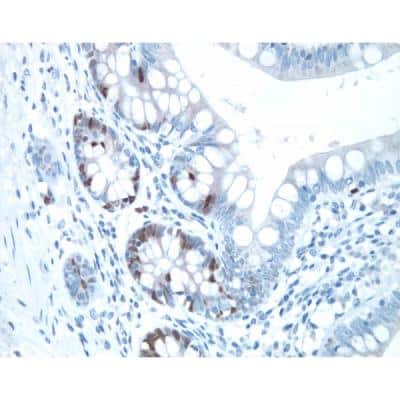 Immunohistochemistry: VECTASTAIN(R) ELITE(R) ABC anti-Rabbit IgG HRP Immunodetection Kit [PK-6101-NB]